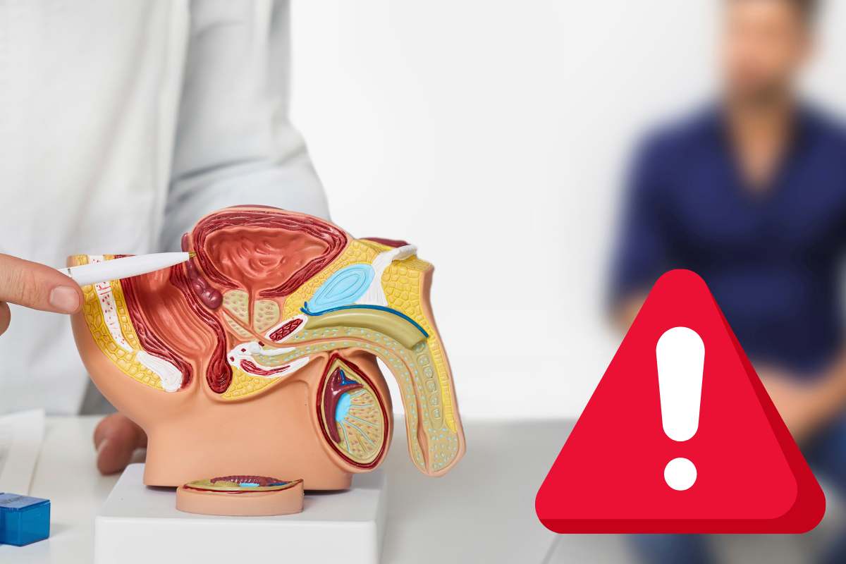Cosa mangiare il cancro alla prostata